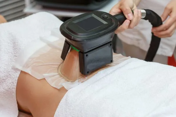 Image of person having fat freezing treatment to help weight gain Leamington Spa