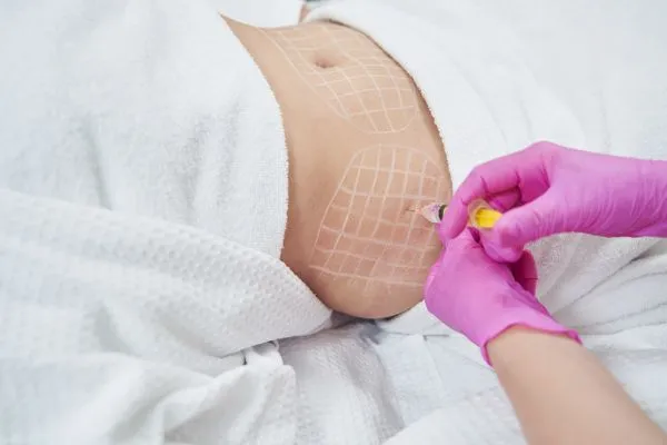 image of fat dissolving injections on love handles to help combat weight gain Leamington Spa