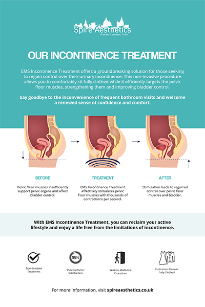 image of how urge incontinence Leamington Spa treatment works