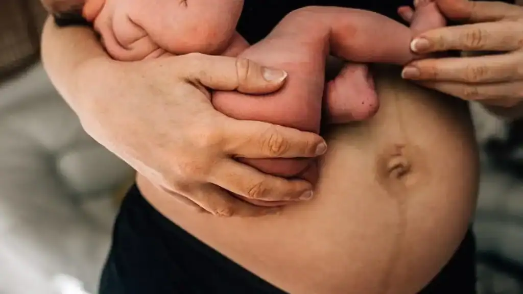 Why Is My Stomach Still Big After Pregnancy Leamington Spa?
